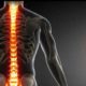 pilates para coluna