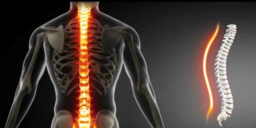 pilates para coluna